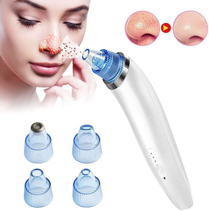 Pore Cleaner (Minimum Order Quantity 1 Carton/144 PCs )