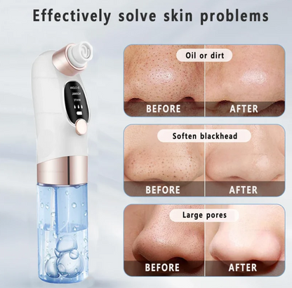 Black & White Head Remover With Vacuum